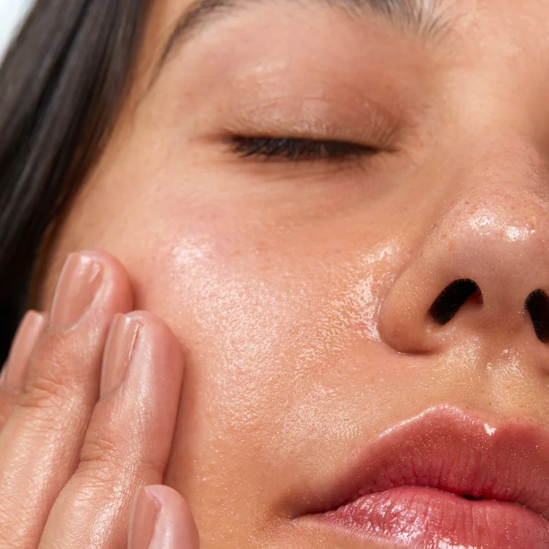 Hyaluronic Acid Fillers